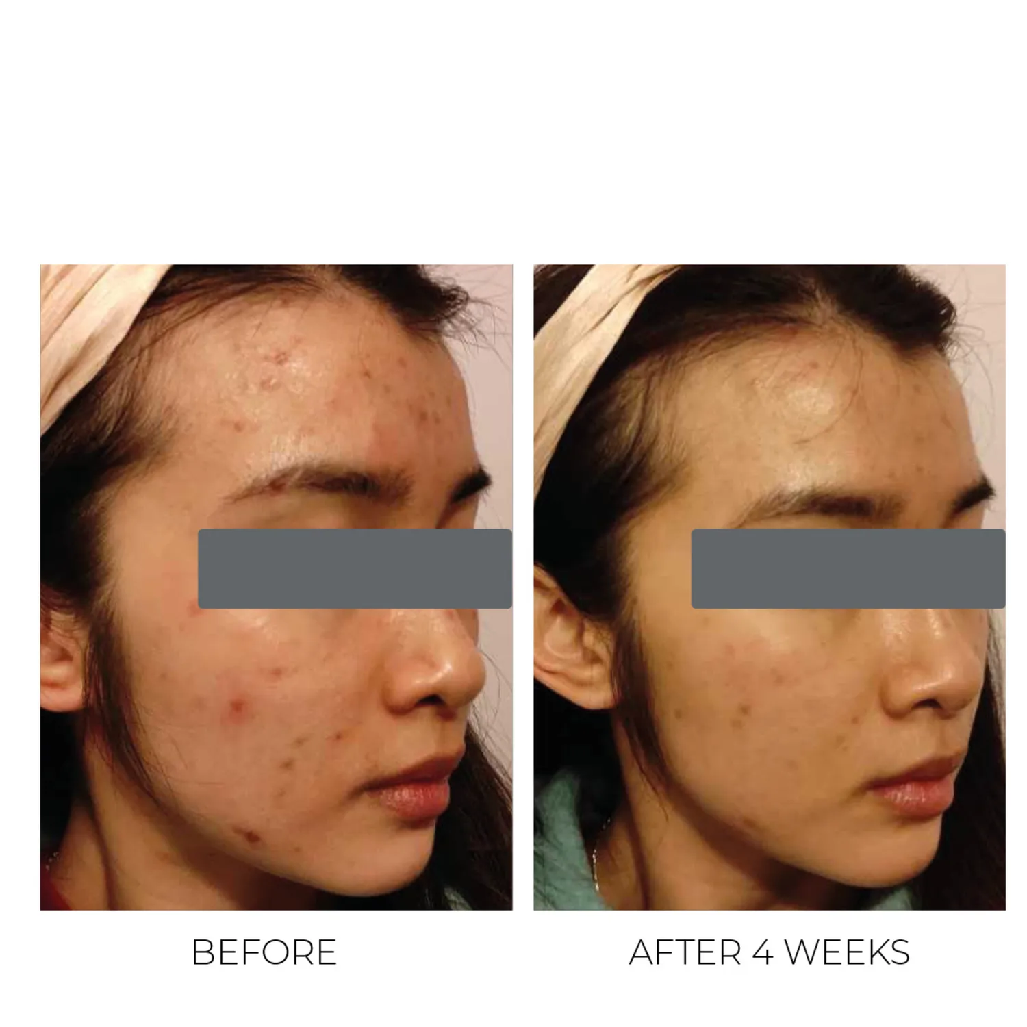 Oskia Violet Water Treatment Tonic tonico pori purificante