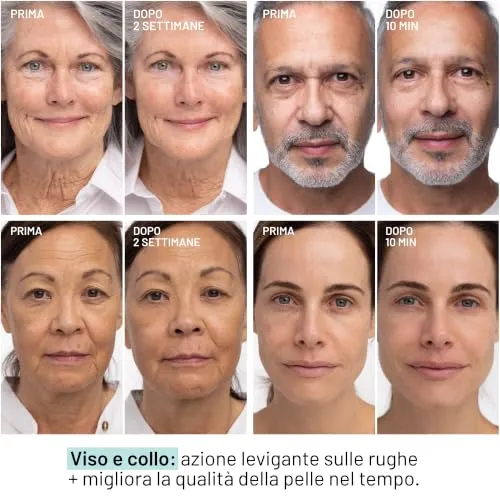 Dr. Brandt Needles No More Wrinkle siero viso 30 ml rughe
