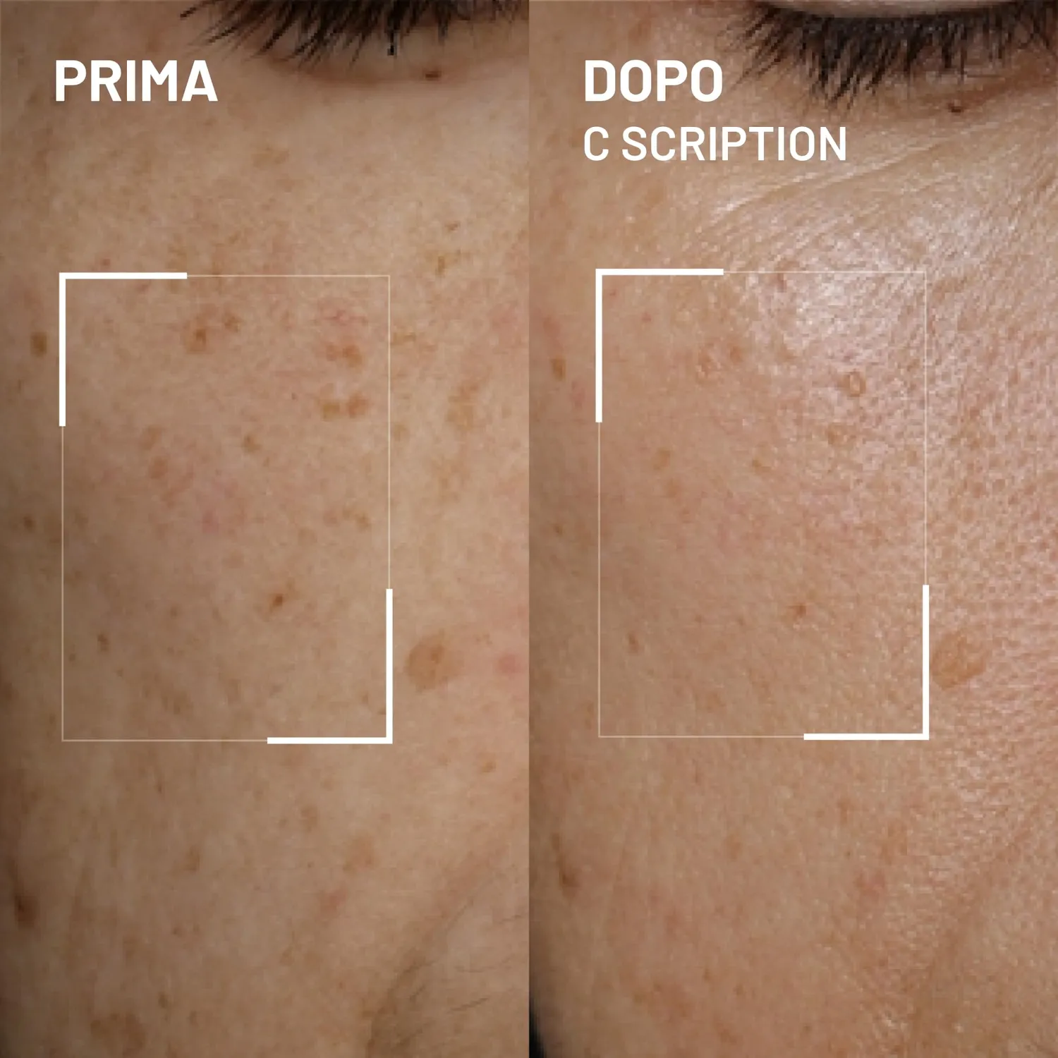 Brandt Bright This Way C Scription siero viso 30 ml vitamina C