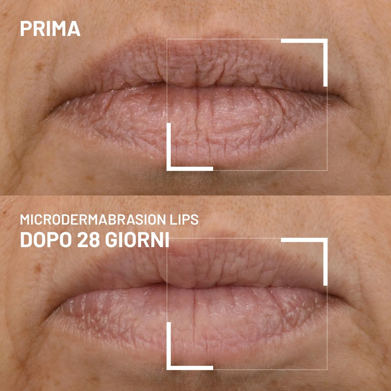 Dr. Brandt Microdermabrasion esfoliante labbra 10 g zucchero