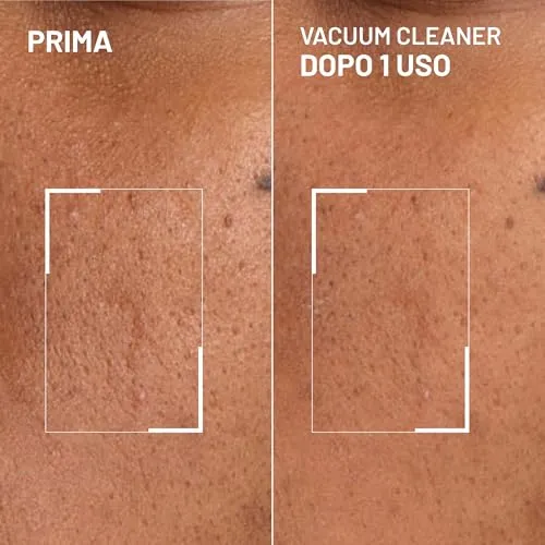 Brandt Pores No More Vacuum Cleaner Maschera Pori 30 g