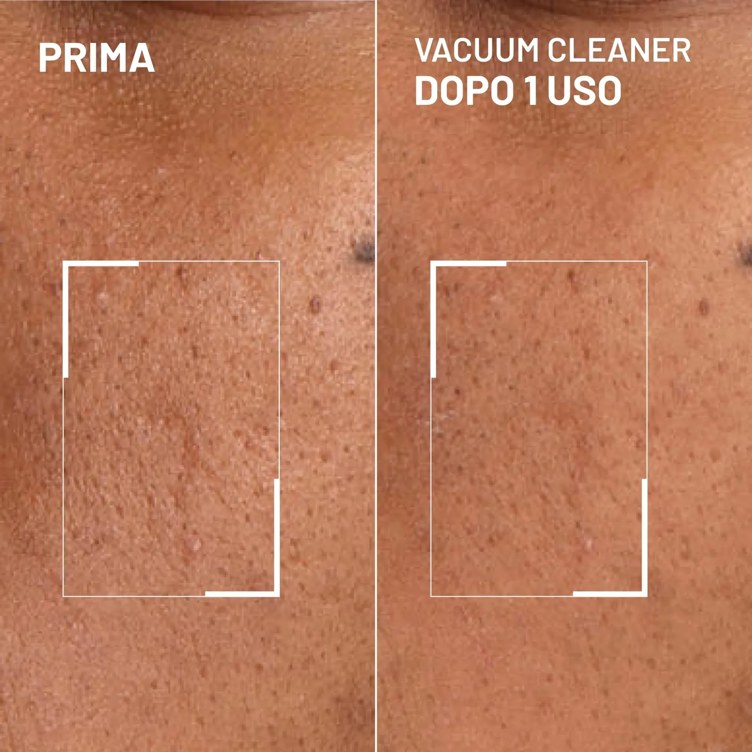 Brandt Pores No More Vacuum Cleaner Maschera Pori 30 g