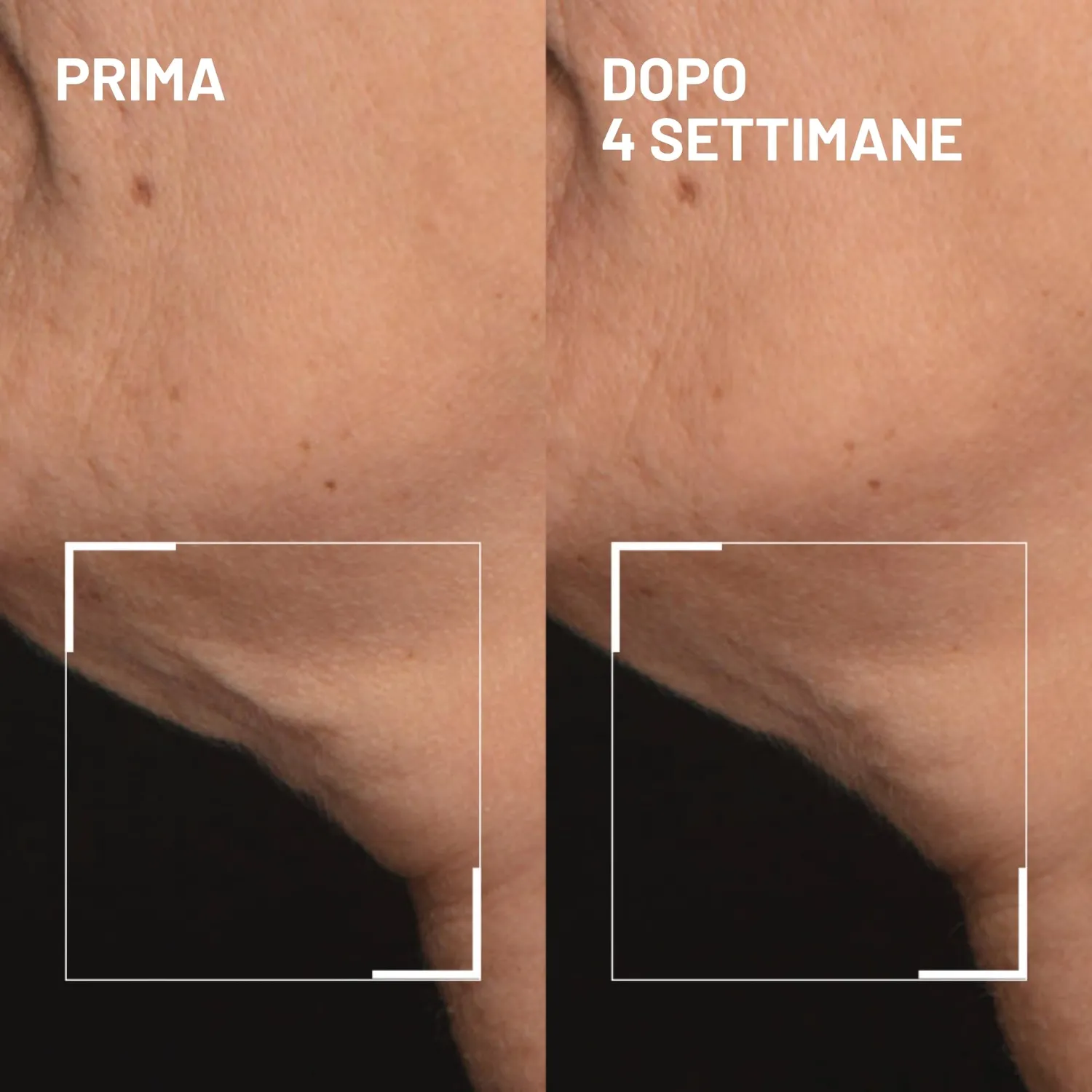 Dr. Brandt Needles No More crema collo rassodante 50 g