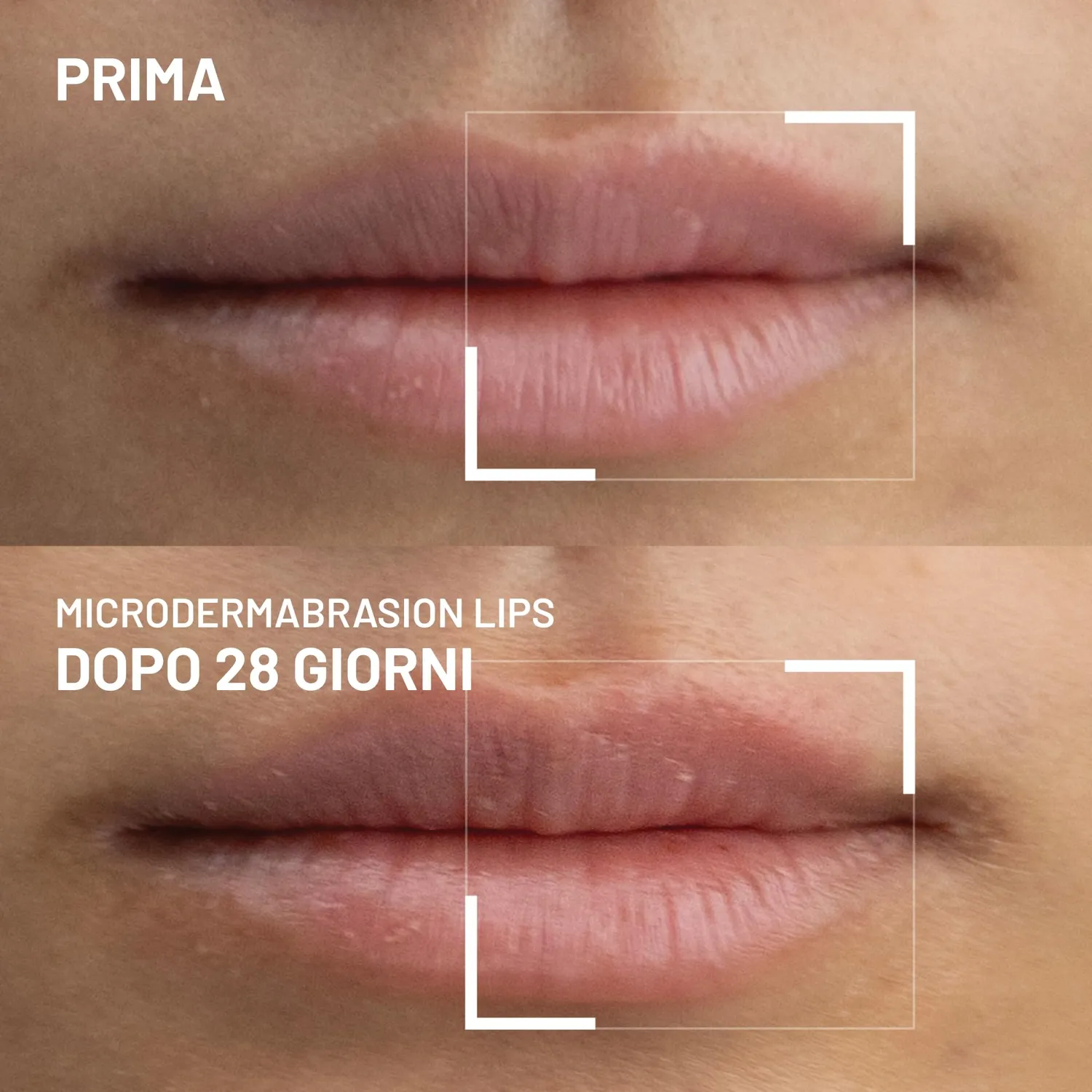 Dr. Brandt Microdermabrasion esfoliante labbra 10 g zucchero