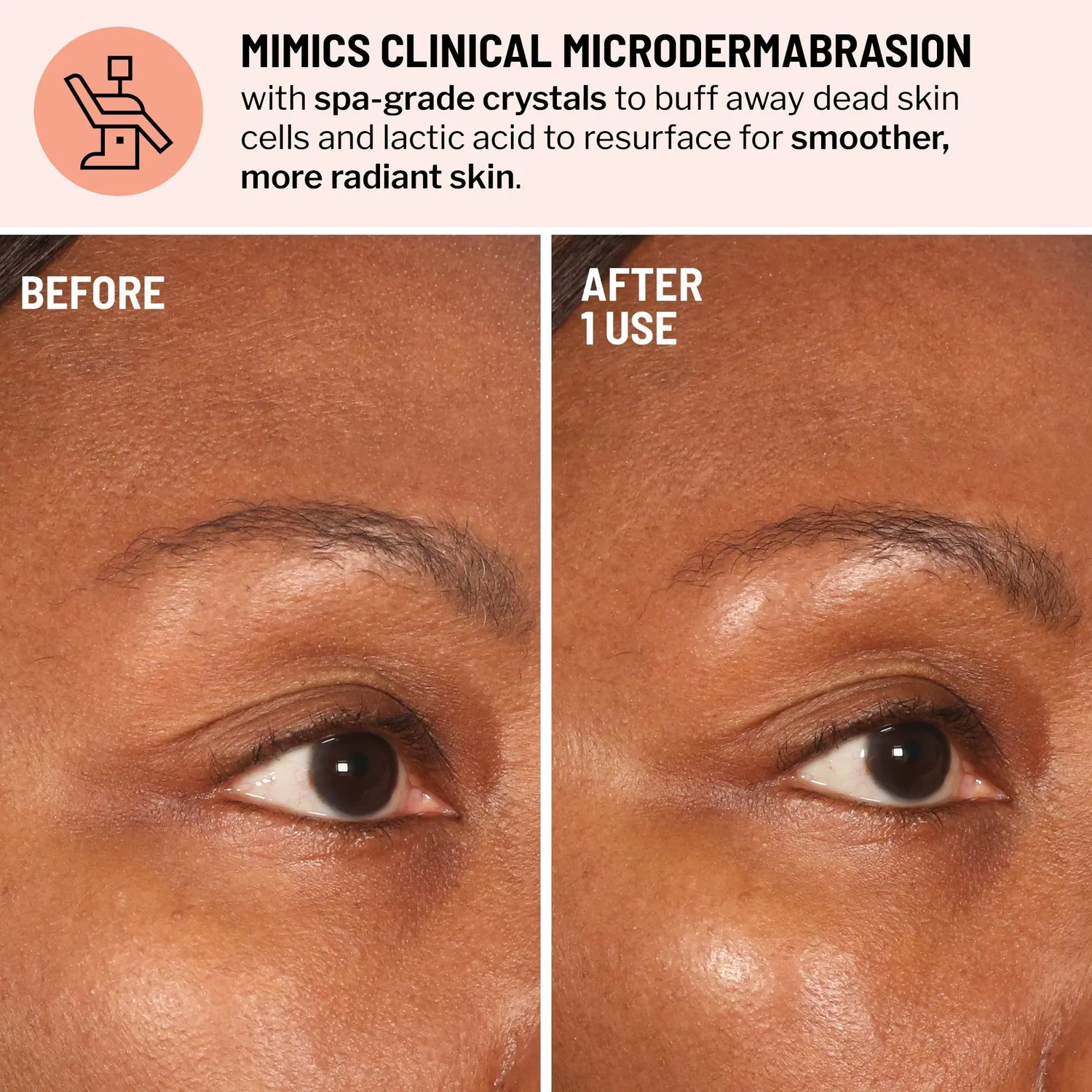 Brandt Advanced Microdermabrasion esfoliante viso 2 oz rughe visibili