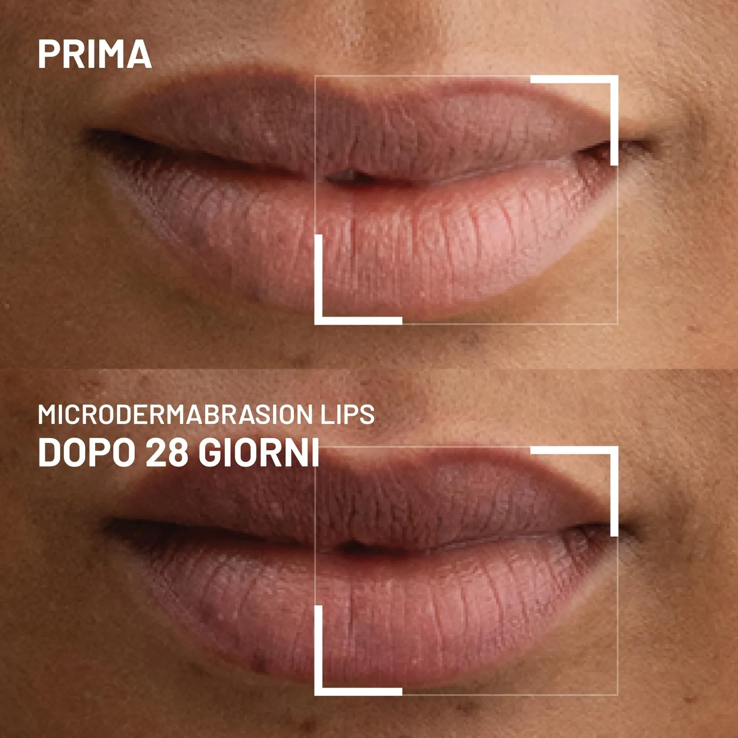 Dr. Brandt Microdermabrasion esfoliante labbra 10 g zucchero