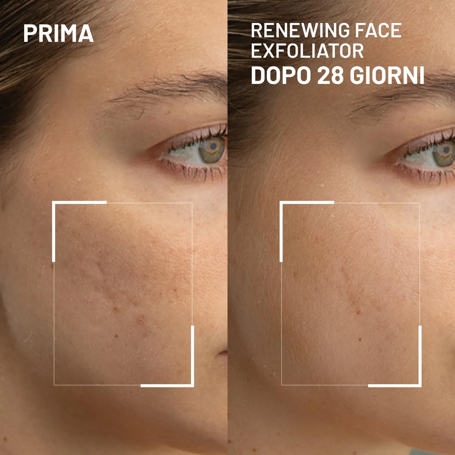 Dr. Brandt Microdermabrasion esfoliante viso 20 g AHA