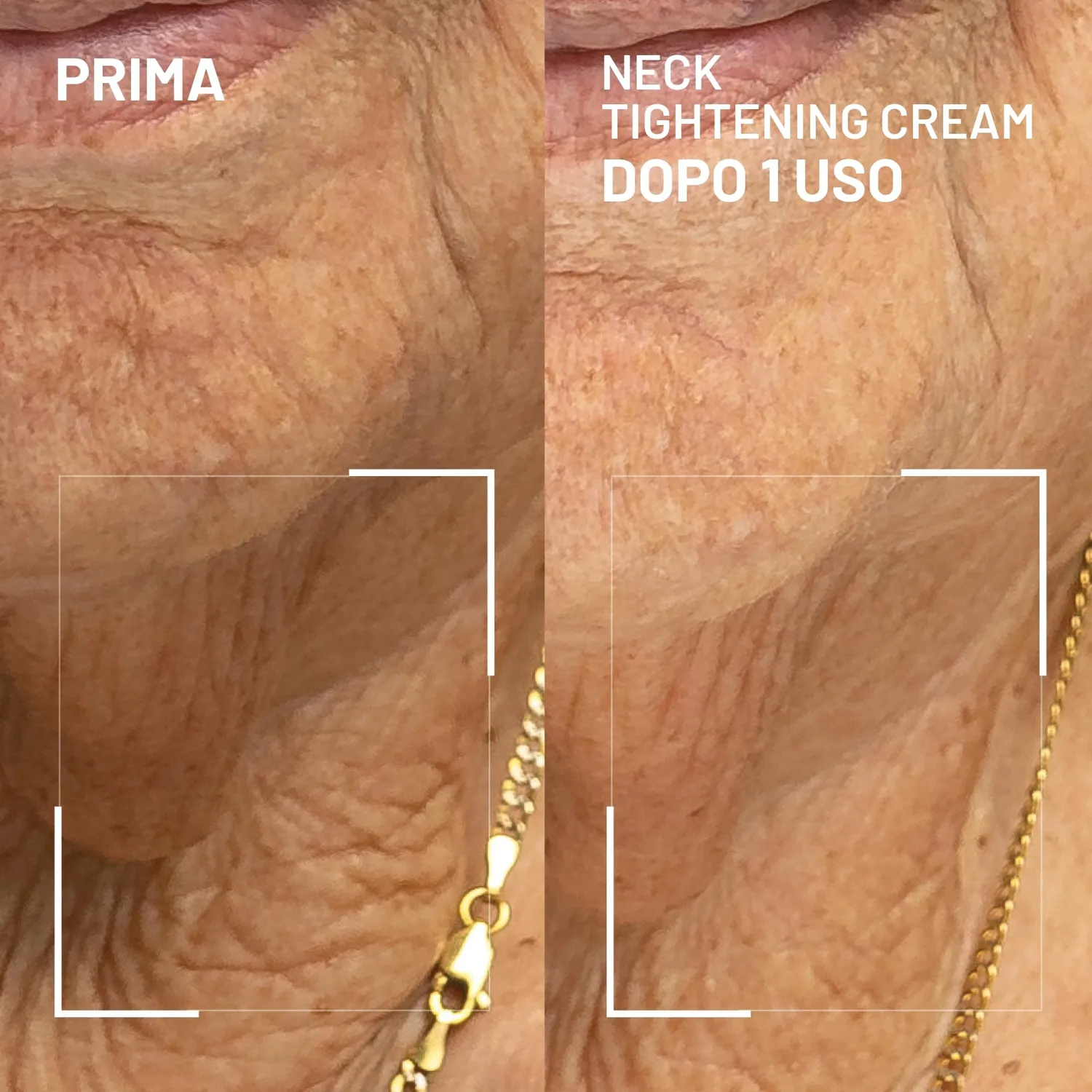 Dr. Brandt Needles No More crema collo rassodante 50 g