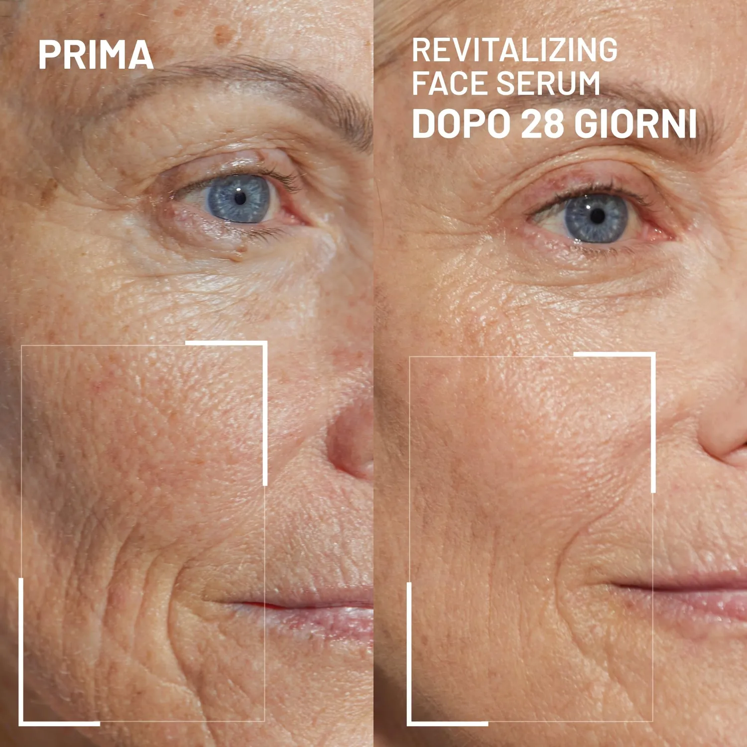 Brandt Dare to Age Siero Viso 30 ml Linee e Rughe