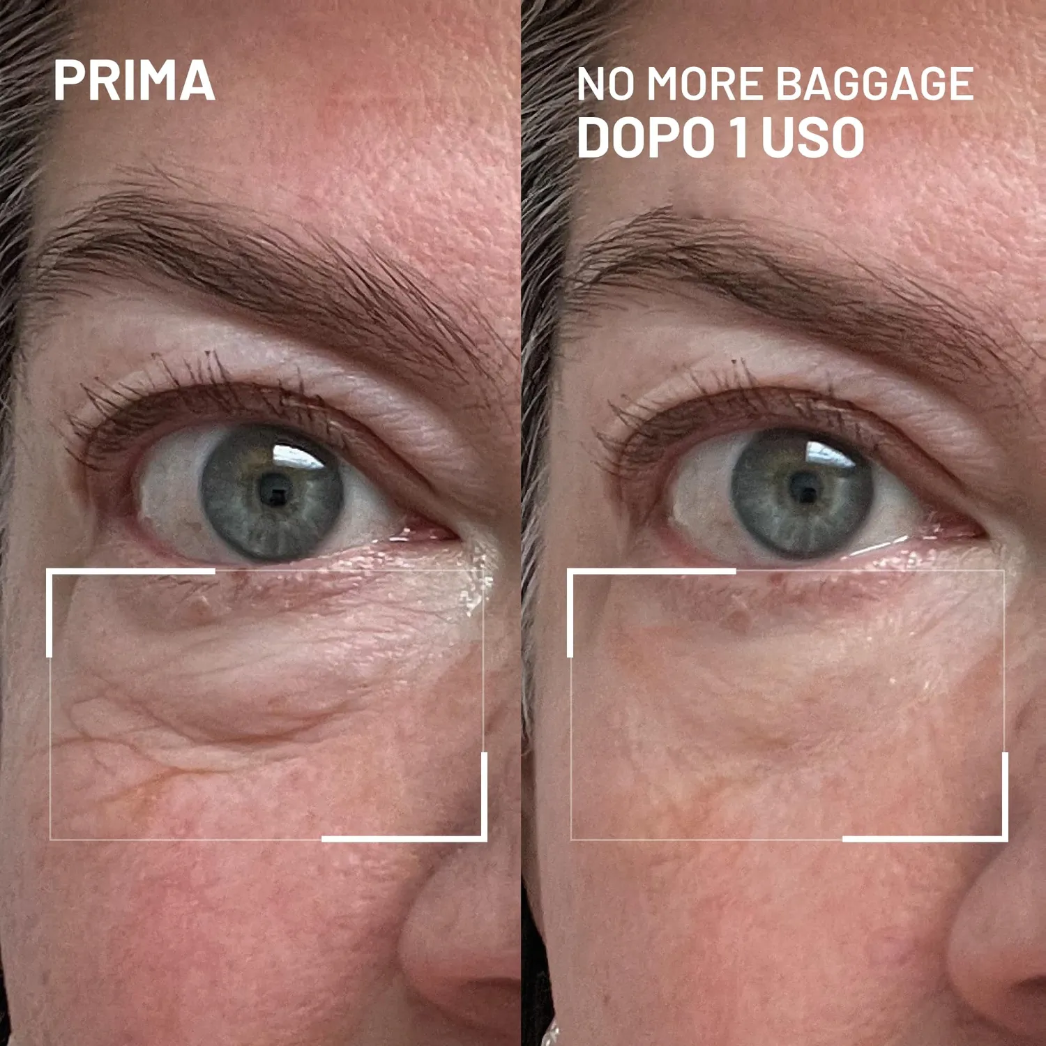 Brandt No More Baggage Gel Occhi 7 g Borse e Occhiaie
