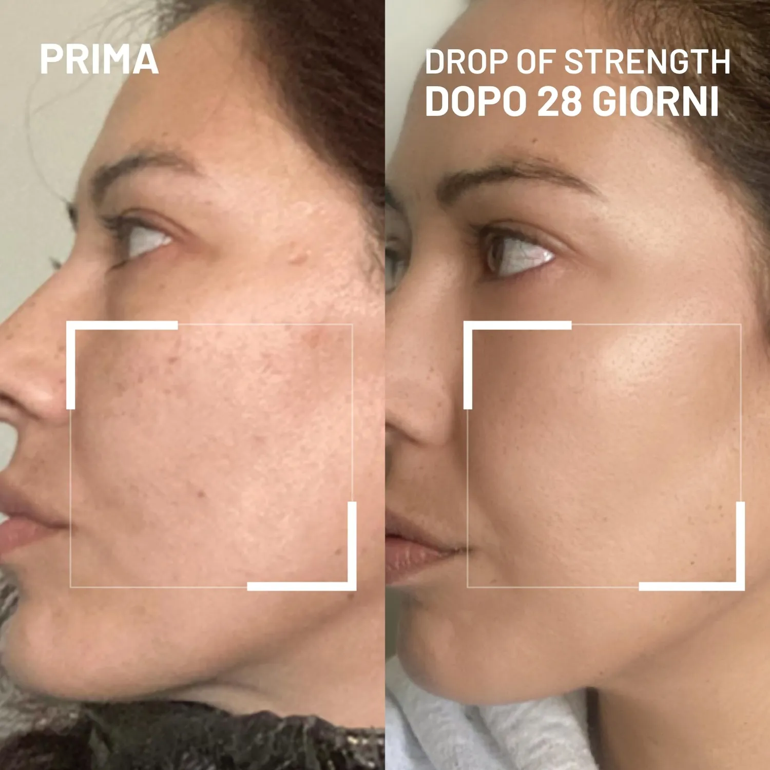 Dr. Brandt Drop of Strength siero viso 15 ml barriera