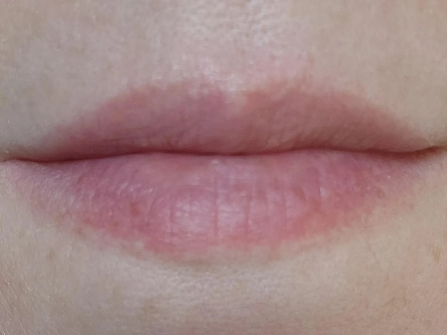 Dr. Brandt Microdermabrasion esfoliante labbra 10 g zucchero