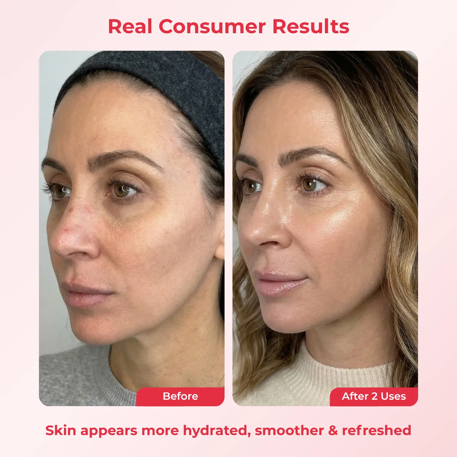 Koriderm PDRN Deep Mask maschera viso 4 pezzi rimpolpante