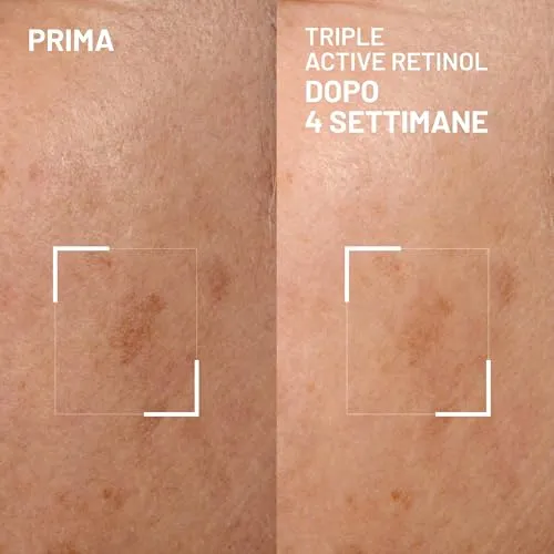 Brandt Triple Active Retinol Crema Notte 30 ml Macchie